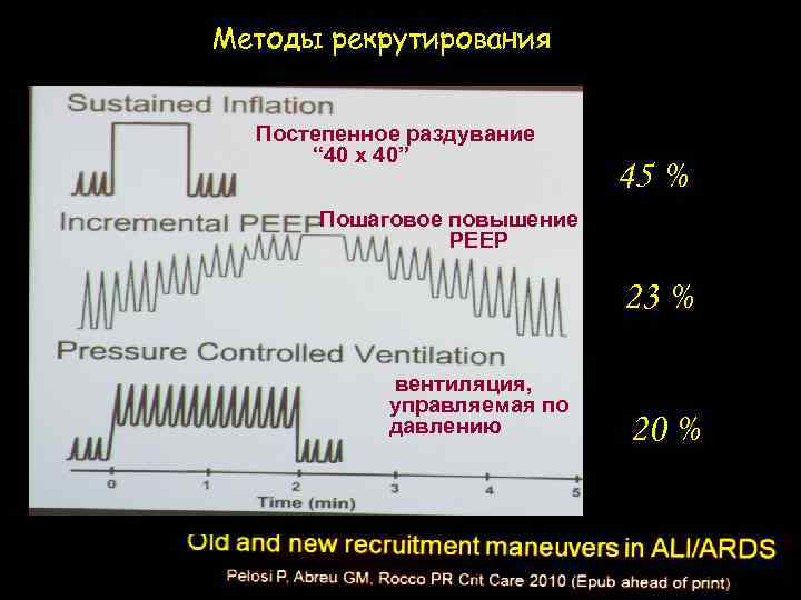 Методы рекрутирования Постепенное раздувание “ 40 х 40” 45 % Пошаговое повышение РЕЕР 23
