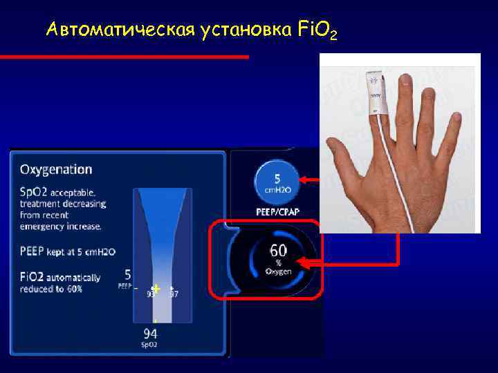 Автоматическая установка Fi. O 2 