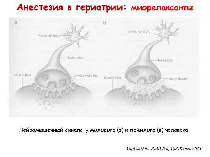 Анестезия в гериатрии: миорелаксанты Нейромышечный синапс у молодого (а) и пожилого (в) человека Yu.