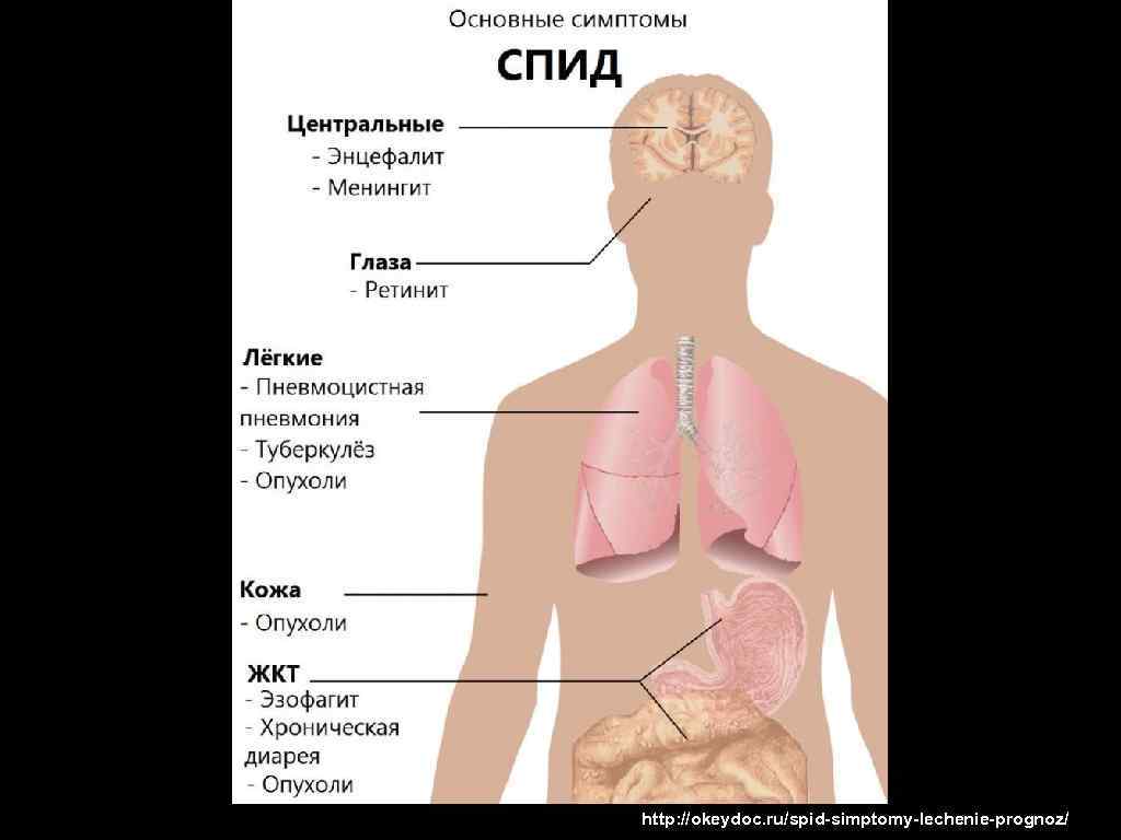 Первичные симптомы вич