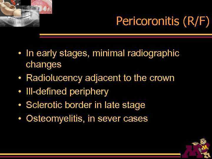 Pericoronitis (R/F) • In early stages, minimal radiographic changes • Radiolucency adjacent to the