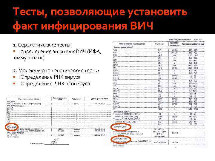 Тесты, позволяющие установить факт инфицирования ВИЧ 1. Серологические тесты: определение антител к ВИЧ (ИФА,