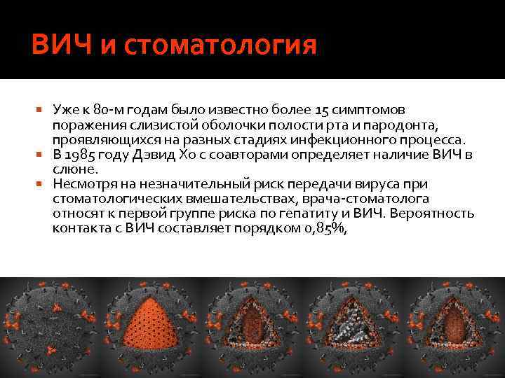 ВИЧ и стоматология Уже к 80 м годам было известно более 15 симптомов поражения