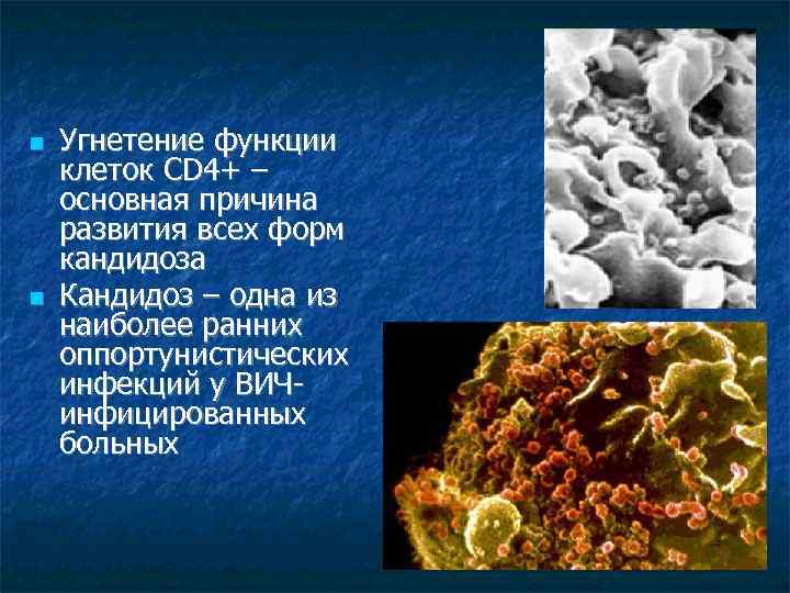  Угнетение функции клеток CD 4+ – основная причина развития всех форм кандидоза Кандидоз