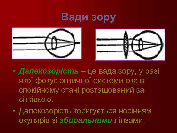 Вади зору • Далекозорість – це вада зору, у разі якої фокус оптичної системи