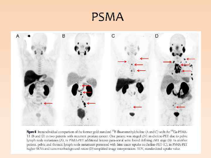 PSMA 