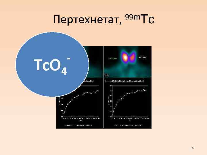 Пертехнетат, 99 m. Tc Tc. O 4 - 32 