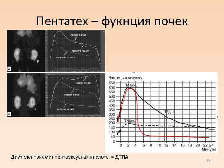 Пентатех – фукнция почек Диэтилентриаминпентауксусная кислота = ДТПА 39 