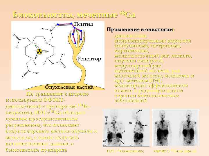 Биоконьюгаты, меченные 68 Ga По сравнению с широко используемой ОФЭКТдиагностикой с препаратом 111 Inоктреотид,