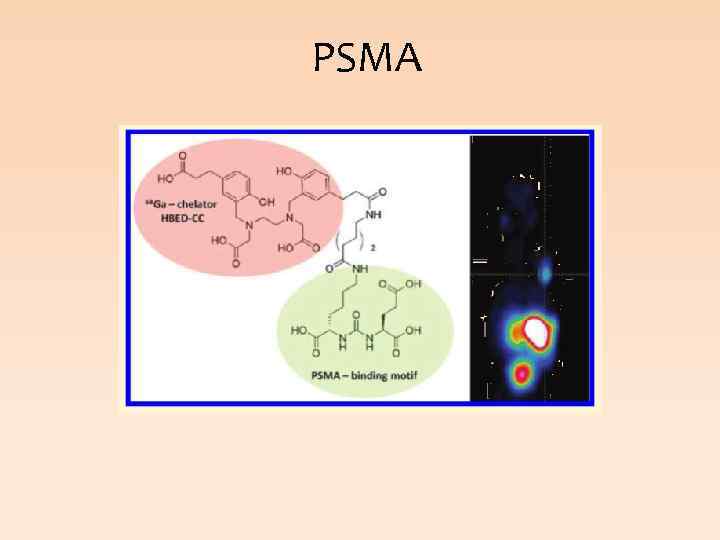 PSMA 