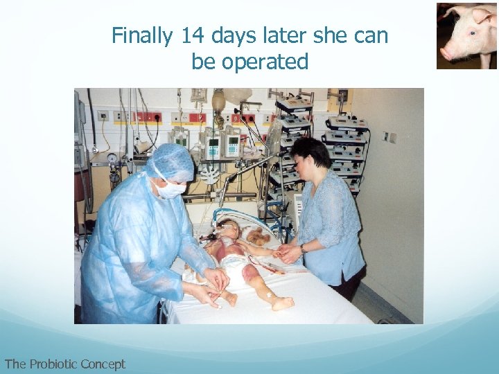 Finally 14 days later she can be operated The Probiotic Concept 