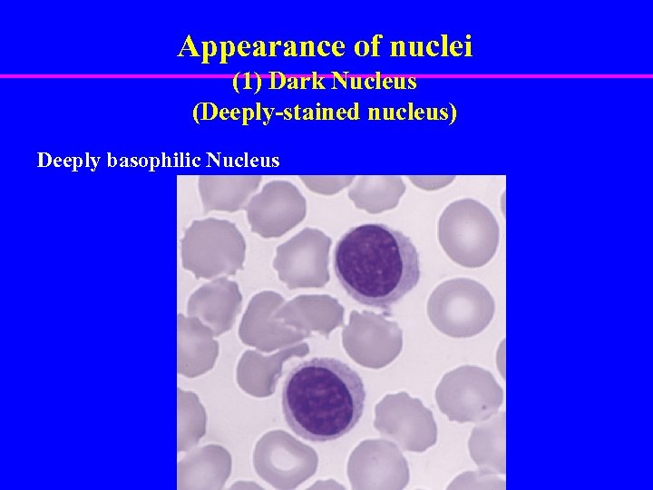 Appearance of nuclei (1) Dark Nucleus (Deeply-stained nucleus) Deeply basophilic Nucleus 