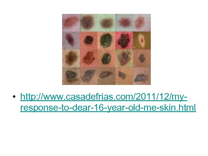  • http: //www. casadefrias. com/2011/12/myresponse-to-dear-16 -year-old-me-skin. html 