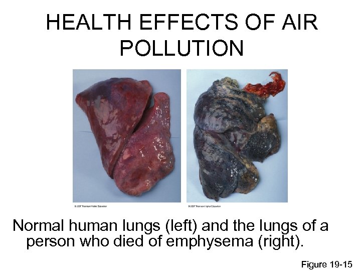 HEALTH EFFECTS OF AIR POLLUTION Normal human lungs (left) and the lungs of a