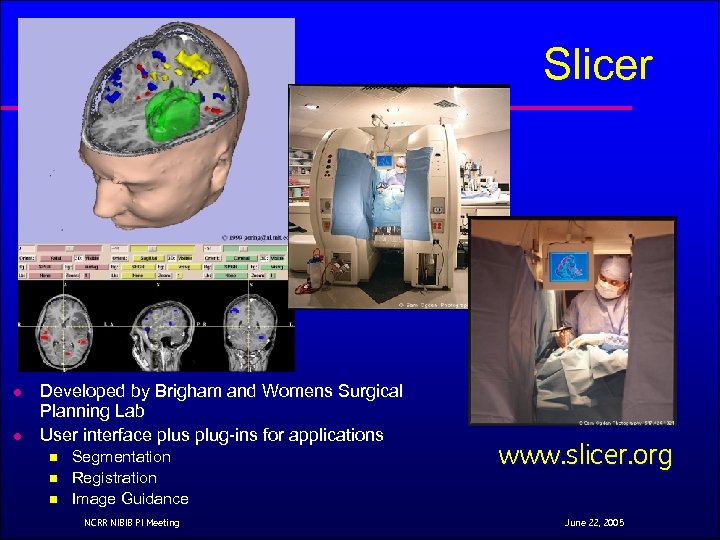 Slicer l l Developed by Brigham and Womens Surgical Planning Lab User interface plus