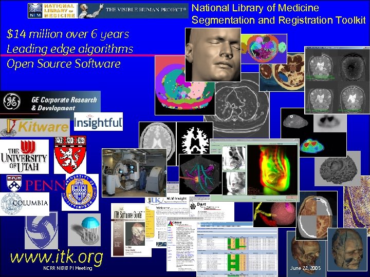 National Library of Medicine Segmentation and Registration Toolkit $14 million over 6 years Leading