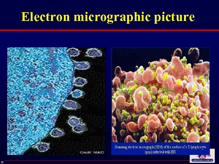 Electron micrographic picture 22 