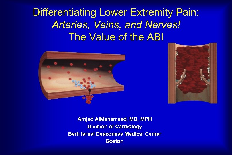 Differentiating Lower Extremity Pain: Arteries, Veins, and Nerves! The Value of the ABI Amjad