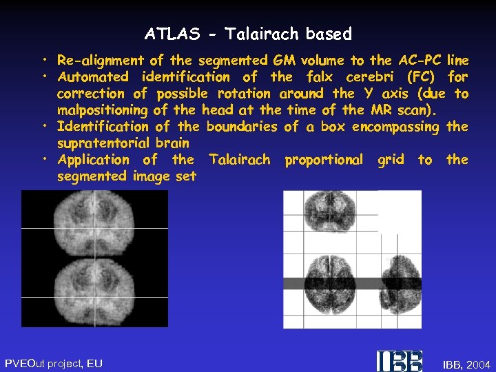 ATLAS - Talairach based • Re-alignment of the segmented GM volume to the AC-PC