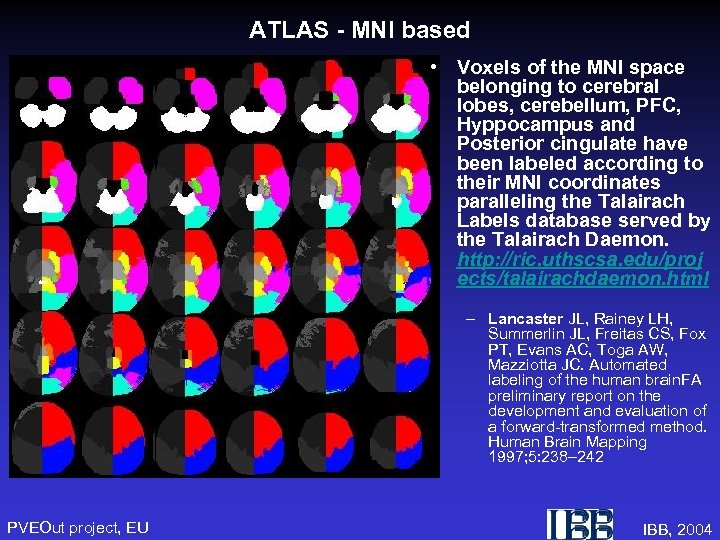 ATLAS - MNI based • Voxels of the MNI space belonging to cerebral lobes,