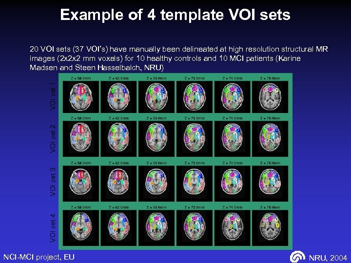 Example of 4 template VOI sets VOI set 4 VOI set 3 VOI set