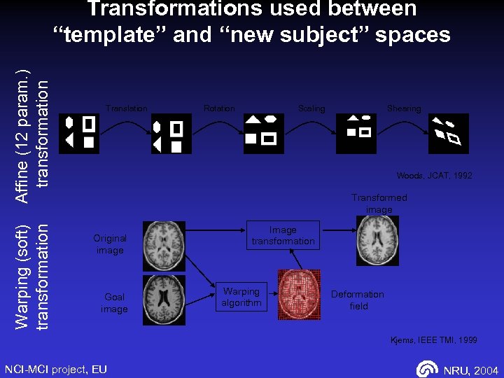 Warping (soft) transformation Affine (12 param. ) transformation Transformations used between “template” and “new