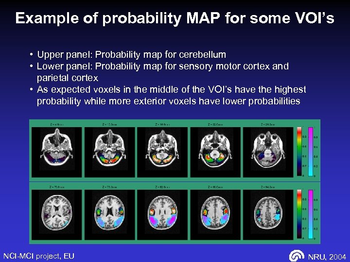 Example of probability MAP for some VOI’s • Upper panel: Probability map for cerebellum