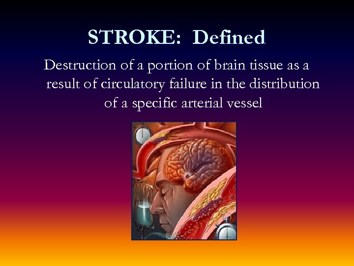 STROKE: Defined Destruction of a portion of brain tissue as a result of circulatory