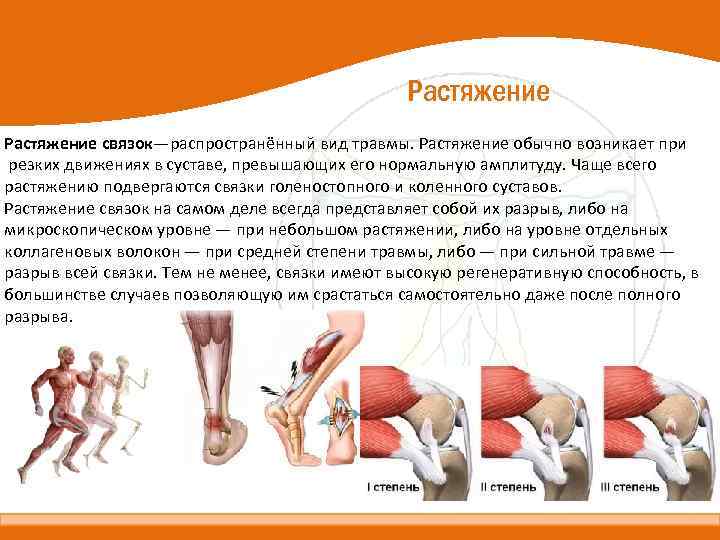 Растяжение связок—распространённый вид травмы. Растяжение обычно возникает при резких движениях в суставе, превышающих его