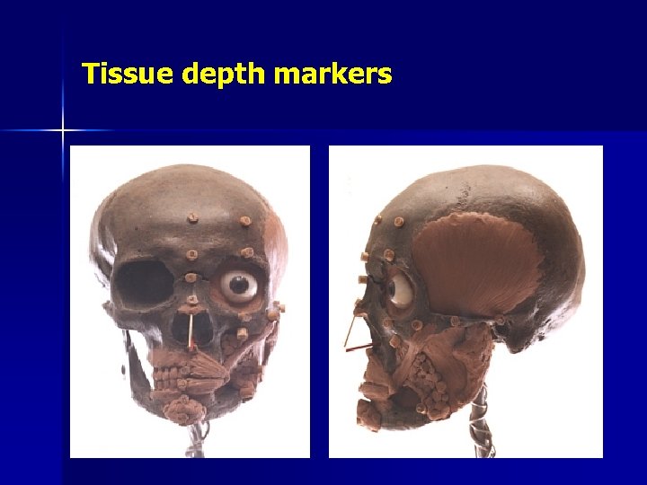 Tissue depth markers 