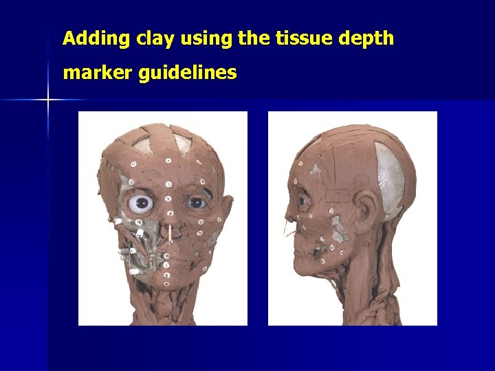 Adding clay using the tissue depth marker guidelines 