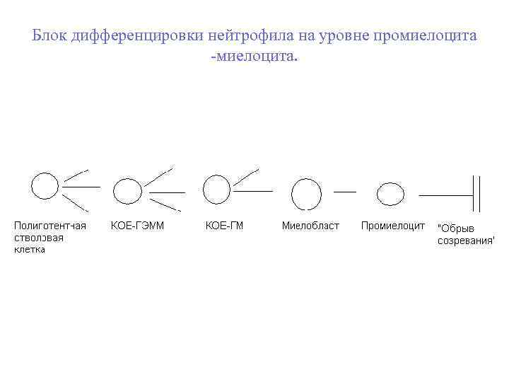 Блок дифференцировки нейтрофила на уровне промиелоцита -миелоцита. 