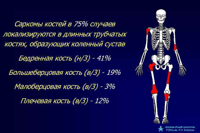 Опухоли костей и мягких тканей презентация