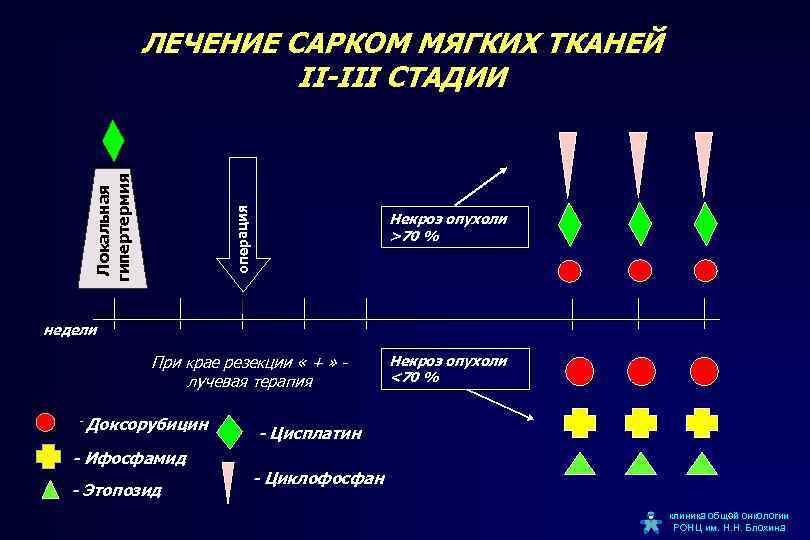 операция Локальная гипертермия ЛЕЧЕНИЕ САРКОМ МЯГКИХ ТКАНЕЙ II-III СТАДИИ Некроз опухоли >70 % недели