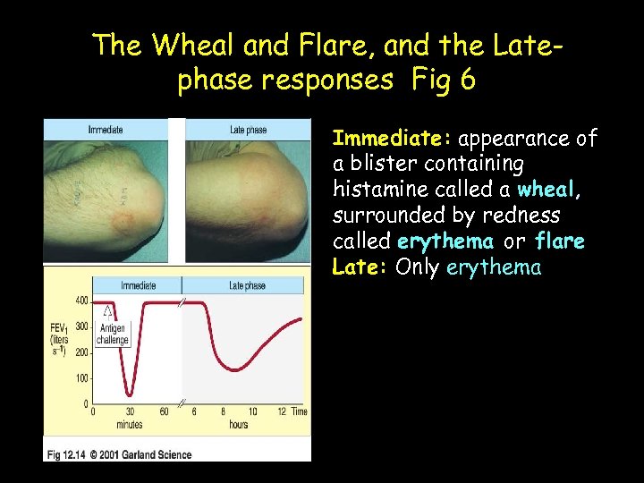 The Wheal and Flare, and the Latephase responses Fig 6 Immediate: appearance of a