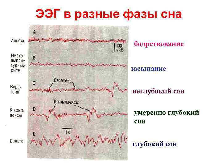 ЭЭГ в разные фазы сна бодрствование засыпание неглубокий сон умеренно глубокий сон 