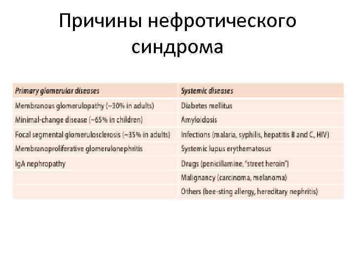 Причины нефротического синдрома 