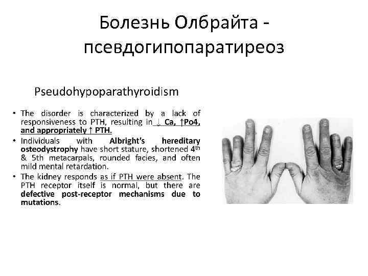 Презентация болезнь олбрайта