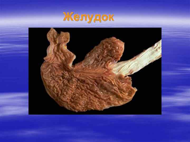 Желудок 