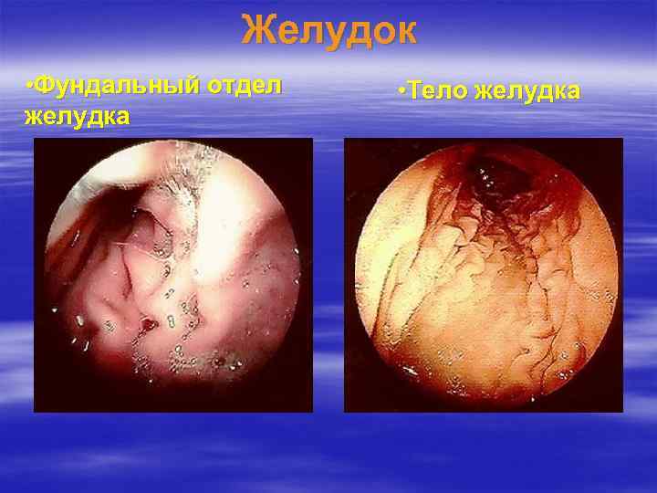 Желудок • Фундальный отдел желудка • Тело желудка 