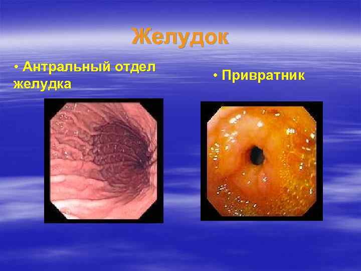 Желудок • Антральный отдел желудка • Привратник 