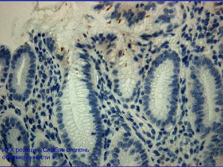 ИГХ реакция. Слабая степень обсемененности + 