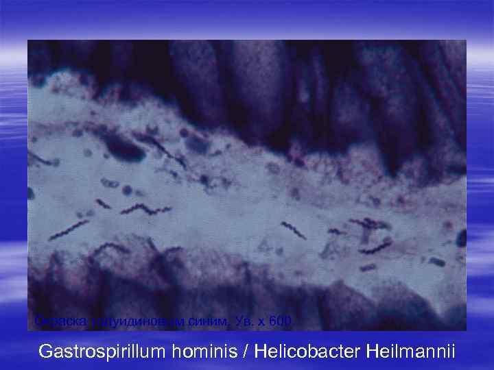 Окраска толуидиновым синим. Ув. х 600. Gastrospirillum hominis / Helicobacter Heilmannii 