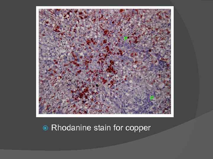  Rhodanine stain for copper 