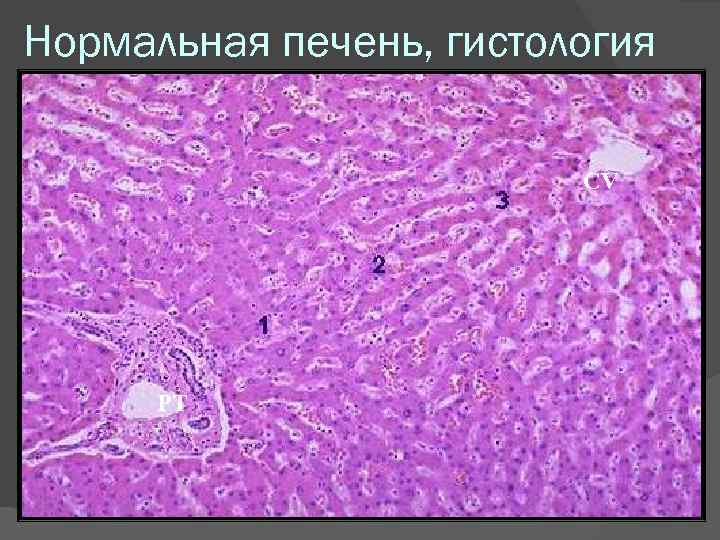 Нормальная печень, гистология CV PT 