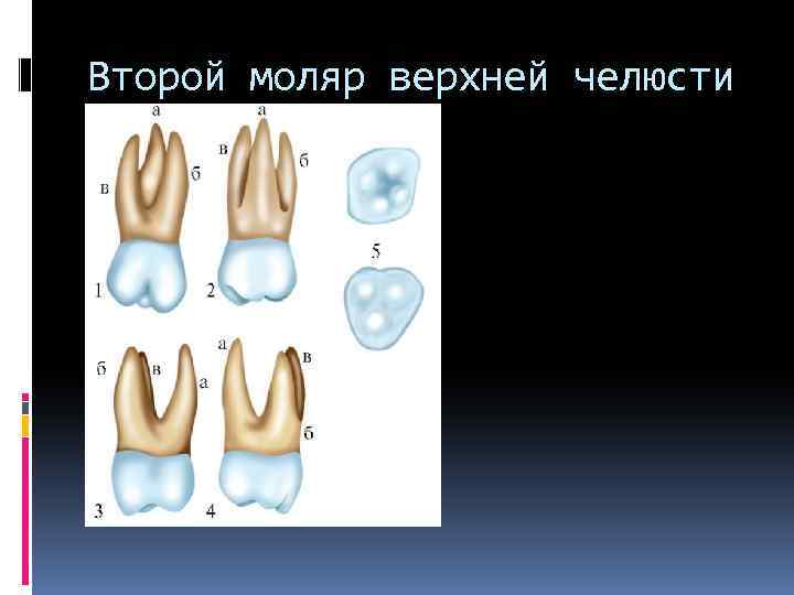 Второй моляр верхней челюсти 