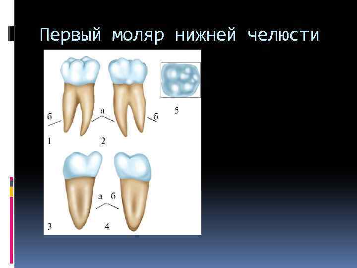 Первый моляр нижней челюсти 