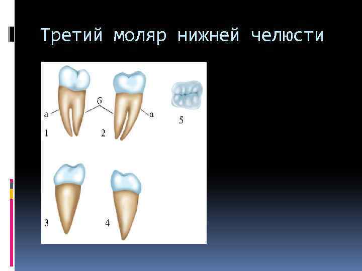 Третий моляр нижней челюсти 