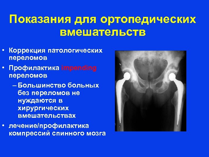 Показания для ортопедических вмешательств • Коррекция патологических переломов • Профилактика impending переломов – Большинство