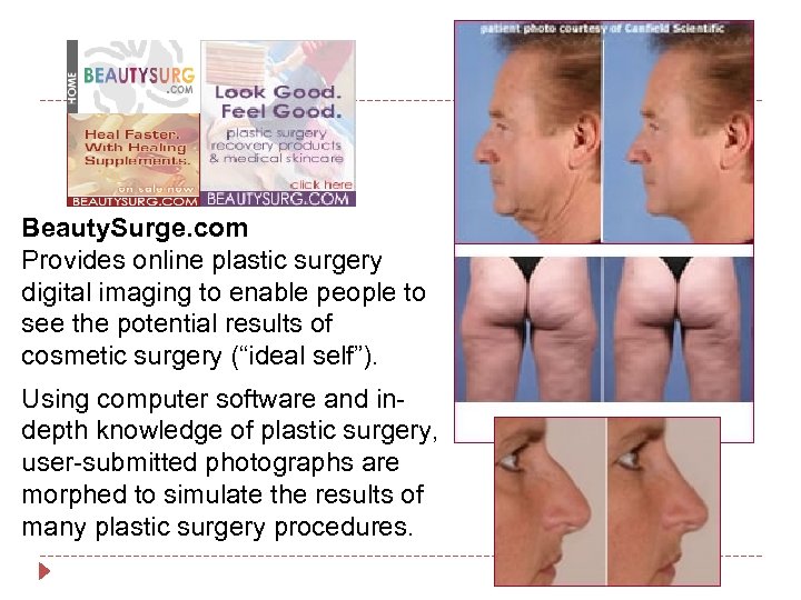 Beauty. Surge. com Provides online plastic surgery digital imaging to enable people to see